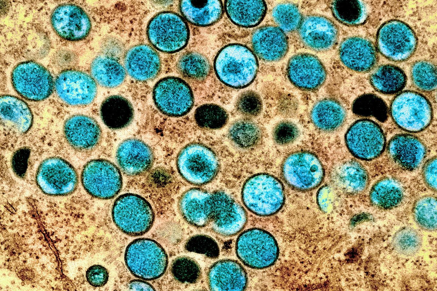 保健大臣、フランスで「散発的な感染」を予想