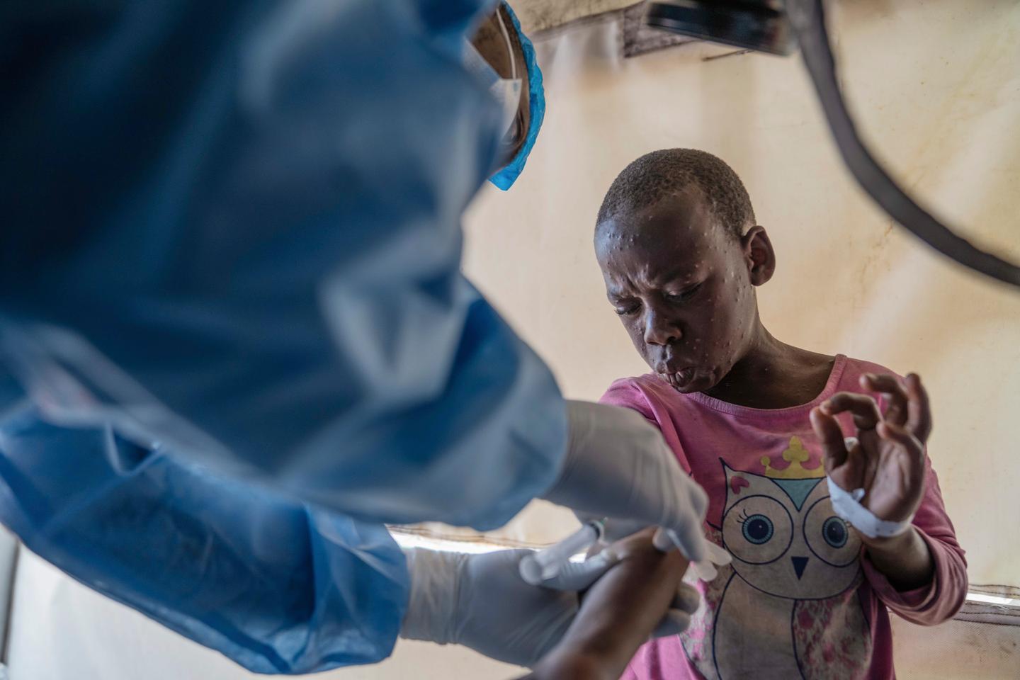 Mpox cases on the rise in DR Congo as nations pledge vaccines