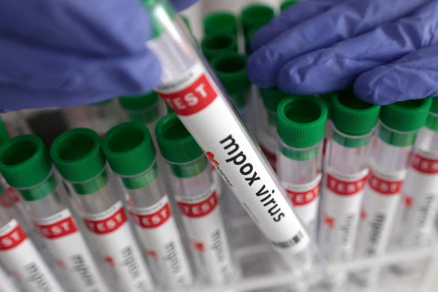 Gabon reports its first mpox case