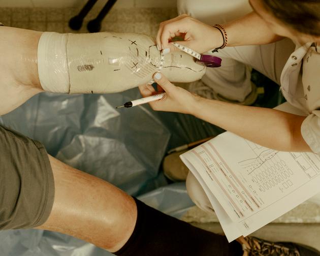 Orthoprosthetist and unit supervisor Laura Rohr makes a cast for a new prosthesis in Valenton, France, on August 22, 2024.