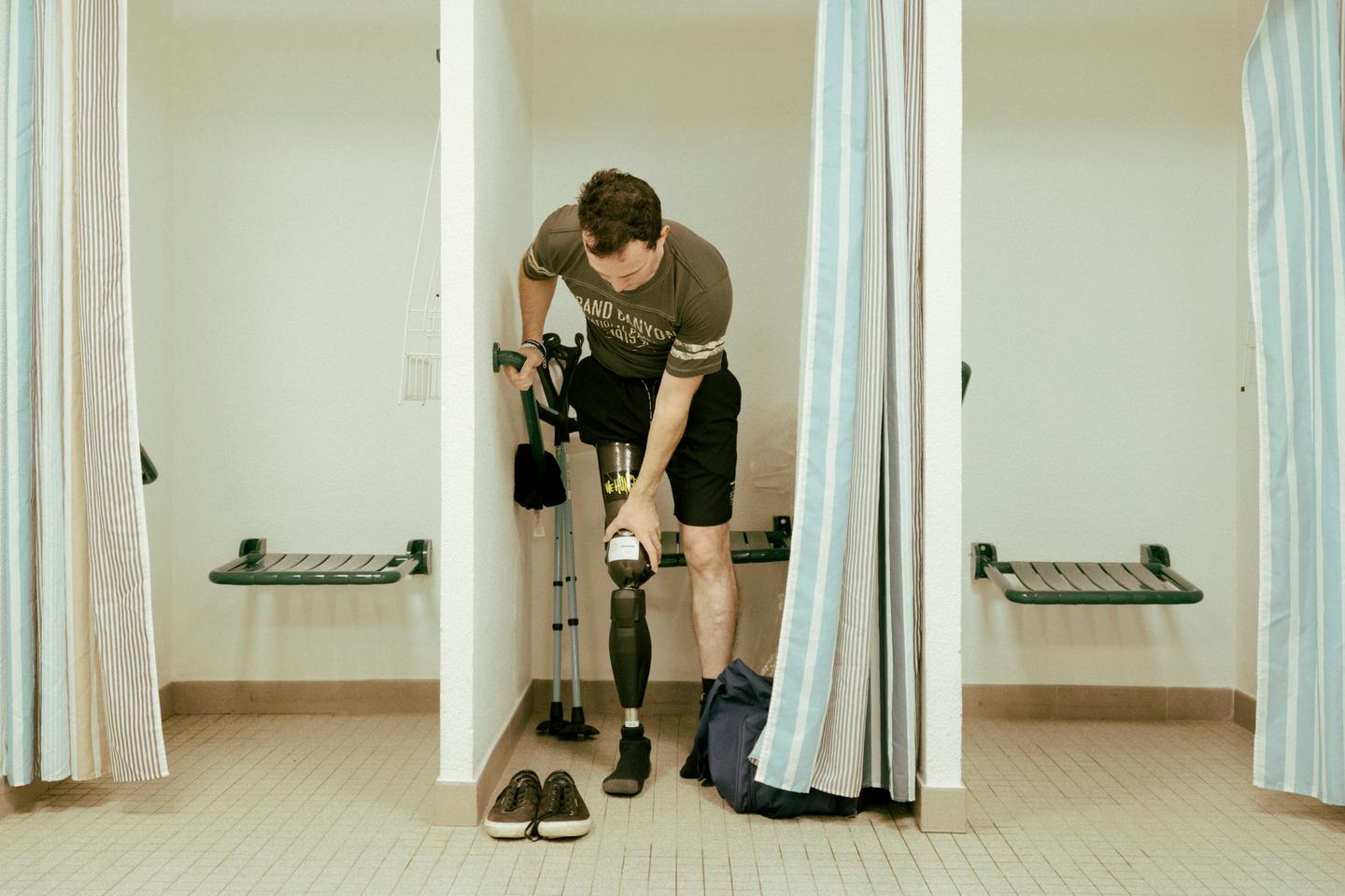 Paris 2024: From amputation to prosthesis, a long road on which research is making progress