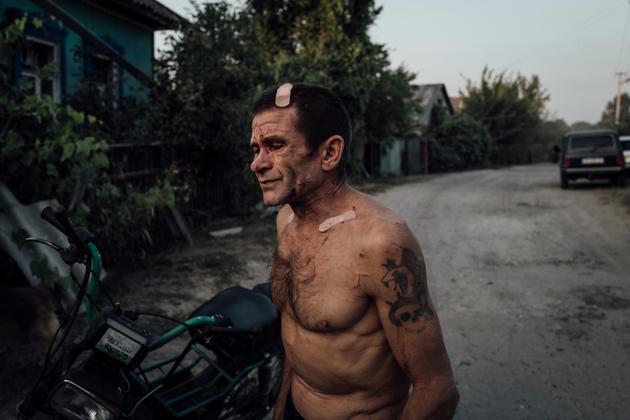 Oleg, 52, in the village of Tokari, Sumy region, on August 25, 2024. He was wounded by shards of glass from a bombing that killed his wife, Lyudmila, 54. He was in the house, and his wife in the garden.
