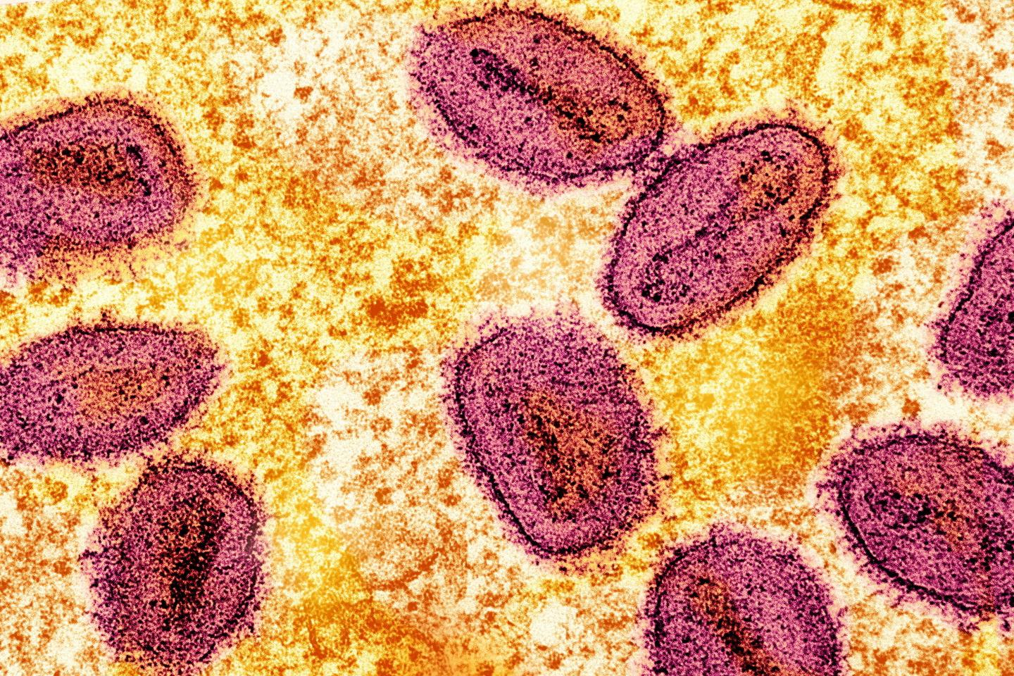 German health authority detects first Congolese Mpox variant case