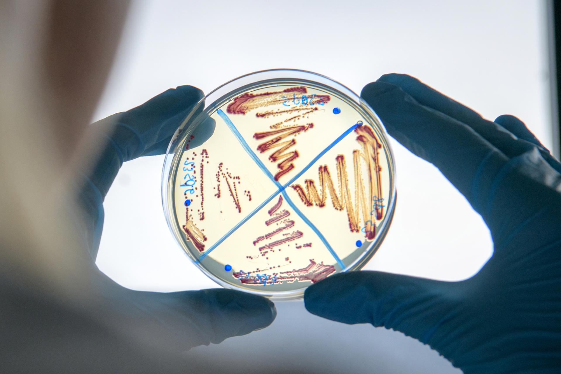 Une technicienne en biologie médicale du CHU de Limoges observe une colonie bactérienne, le 4 octobre 2024.