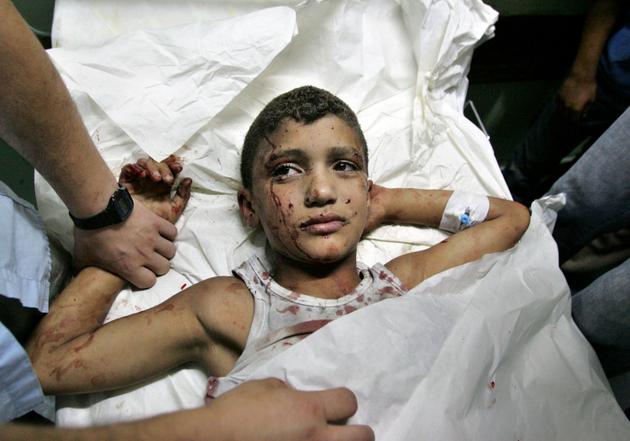 Palestinian doctors treat a boy wounded by an Israeli air strike in Gaza City, July 8, 2006.