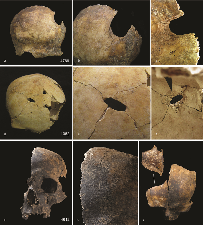 Ces crânes vieux d’environ quatre mille ans, retrouvés en Angleterre, ont subi divers types de traumatisme, tels que des coupures ou des perforations.