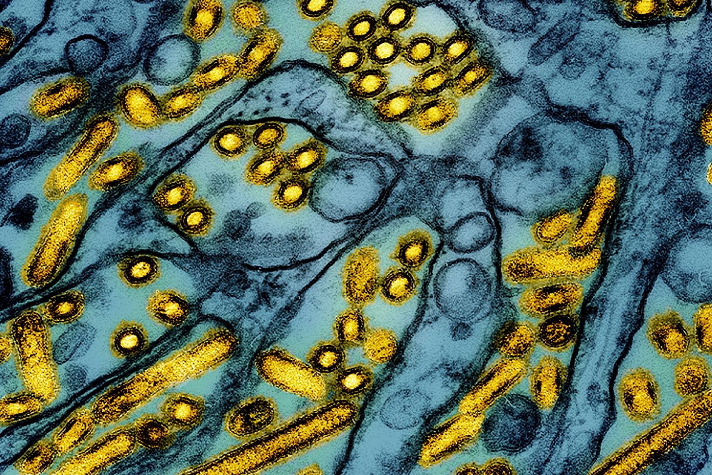 Camille Besombes, infectiologue : « La circulation mondiale du virus hautement pathogène H5N1 est particulièrement préoccupante »
