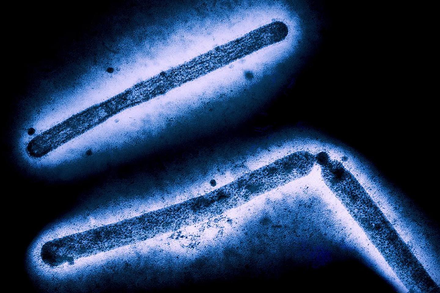 US records its first human death from bird flu