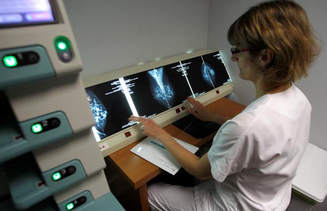Radiografias da mama, após exame de saúde preventivo contra o câncer de mama, no hospital Ambroise-Paré, em Marselha, em abril de 2008.