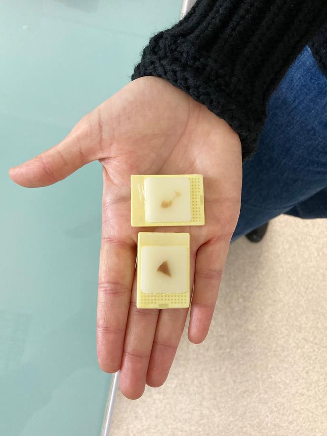 Biopsies de la première xénogreffe d’un rein de porc génétiquement modifié chez des receveurs humains conservées dans de la paraffine, à l’Institut de transplantation et de régénération d’organes de Paris (Pitor) de l’université Paris Cité, le 20 janvier 2025.