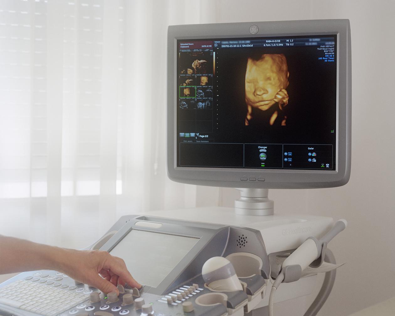 Le déni de grossesse, un trouble fréquent et encore mystérieux pour les ...