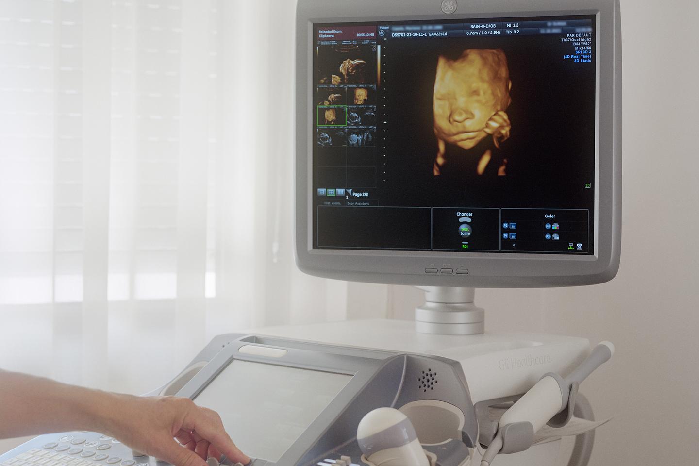 Pregnancy denial, a frequent but mysterious disorder for doctors