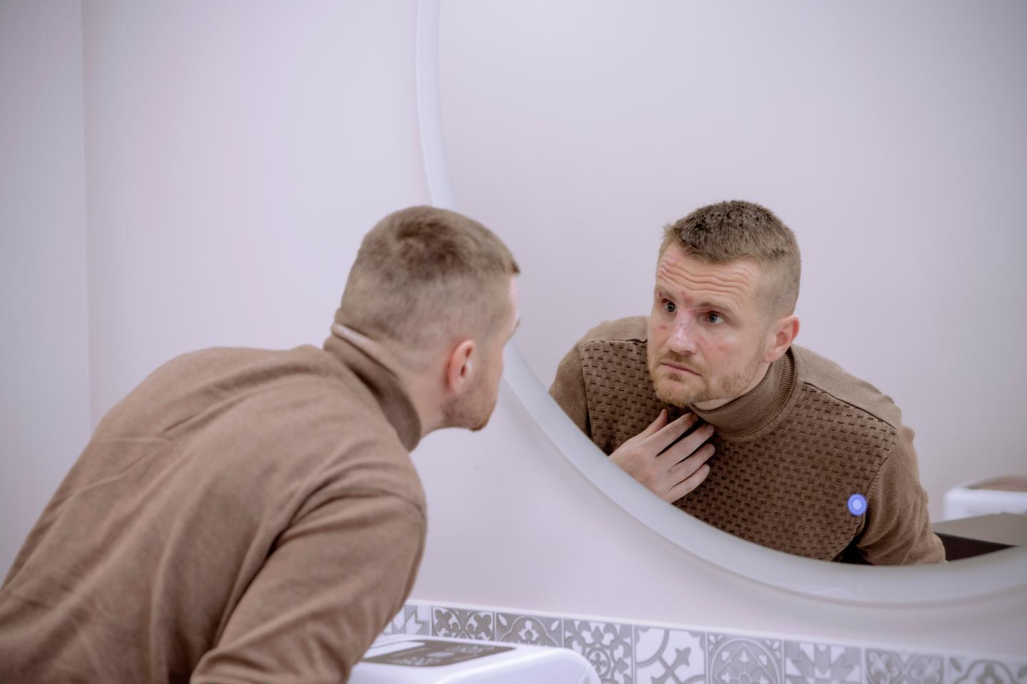 'This terrifying face is the true face of war': A new lease on life for Ukraine's 'broken faces'
