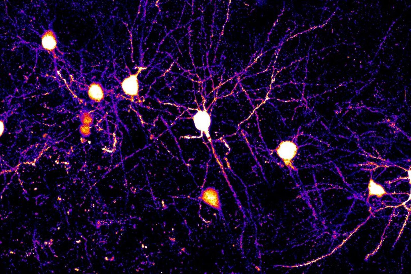 La mécanique de la mémoire observée à l’échelle d’un neurone