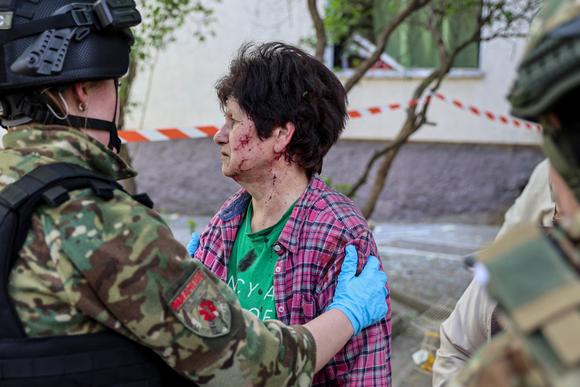 Une résidente blessée lors de l’attaque russe, à Zaporijia, le 22 avril 2025.