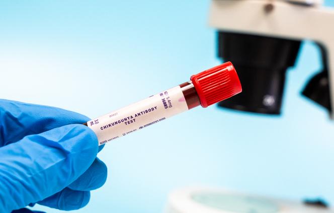 Test sanguin de détection des anticorps du Chikungunya.