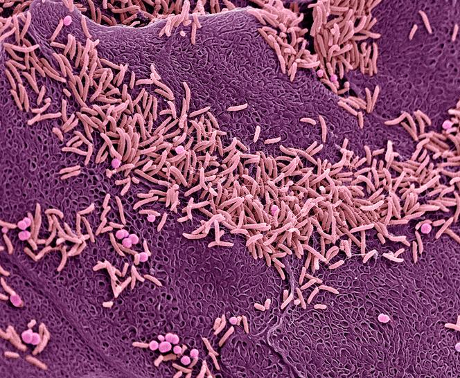 Micrographie électronique à balayage colorée de bactéries sur la paroi vaginale.
