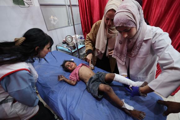 Un enfant blessé reçoit des soins médicaux à l’hôpital Al-Awda du camp de réfugiés de Nousseirat, dans le centre de la bande de Gaza, à la suite d’une frappe israélienne, le 29 mai 2025.