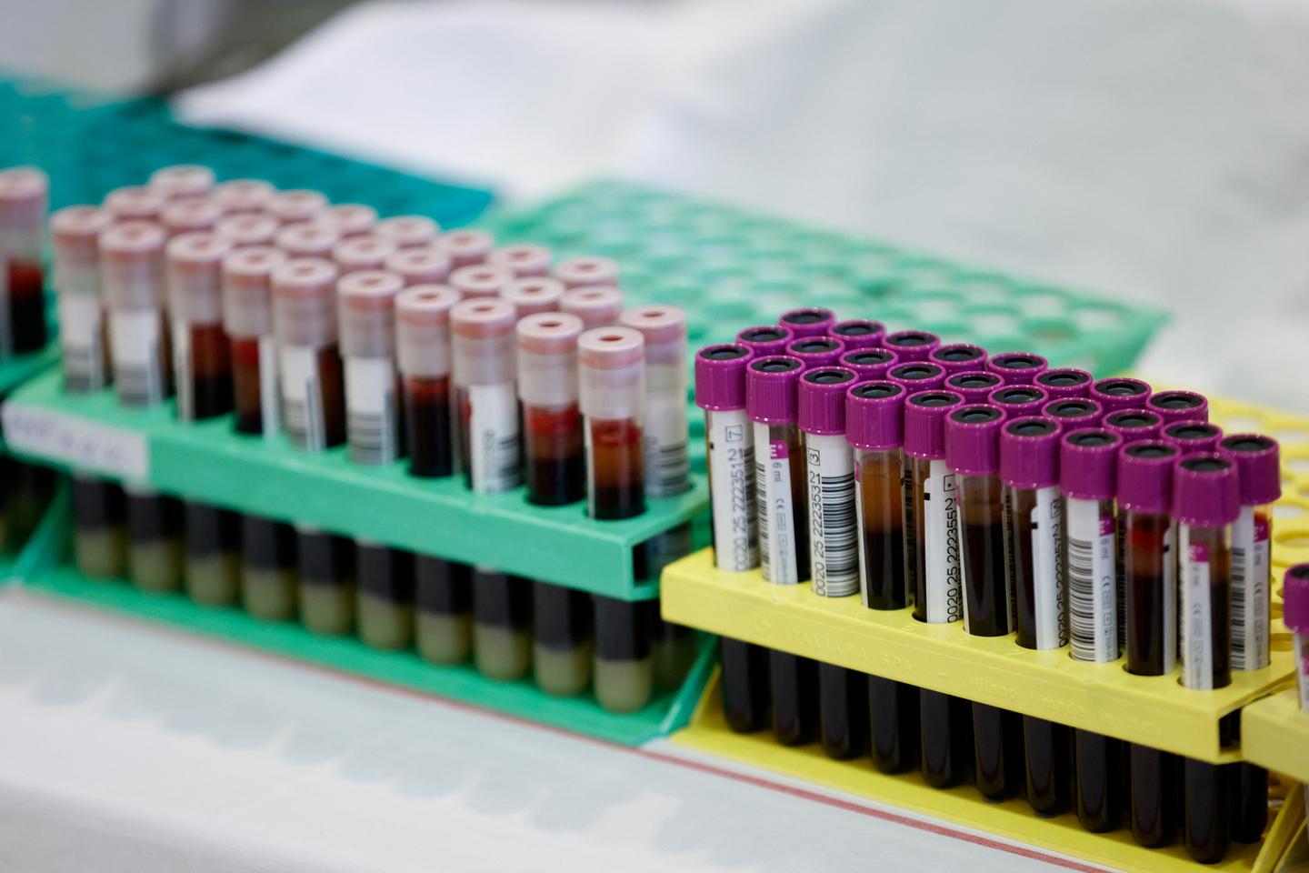 'Gwada negative': French scientists find new blood type in woman