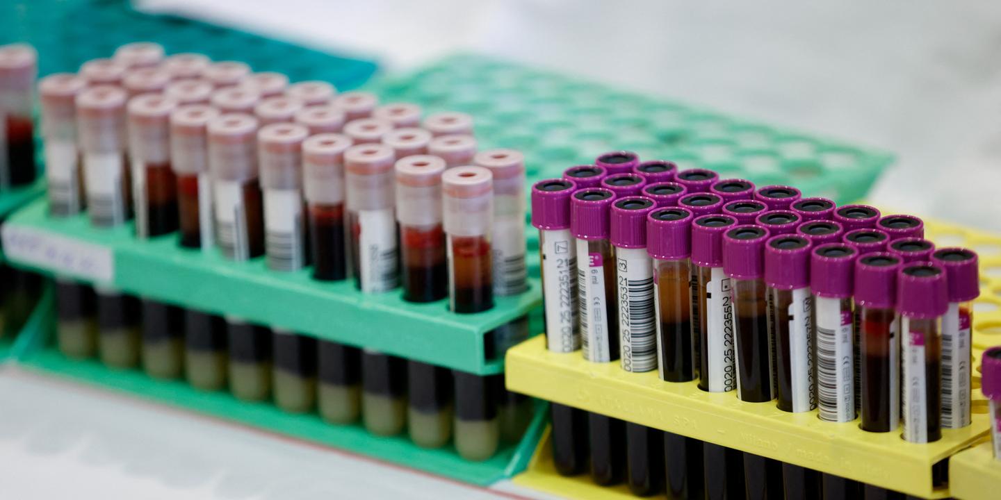 'Gwada negative': French scientists find new blood type in woman