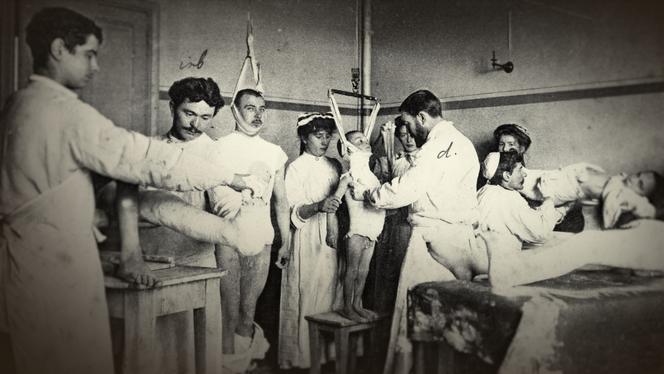 Des médecins redressent la colonne vertébrale de deux patients handicapés avec la méthode de mécanothérapie, au début du XXe siècle, image extraite du documentaire « Handicap, aux origines du combat », réalisé par Laetitia Moller.