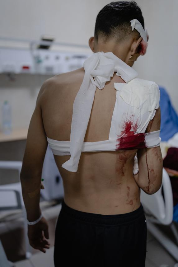Amir, 15, was shot while trying to reach his father. At the Ramallah hospital, June 26, 2025.