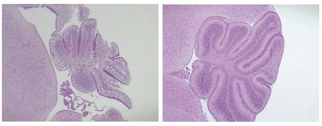 A gauche, le cerveau d’une souris atteinte d’encéphalopathie HPDL. A droite, le traitement a rétabli la taille et le développement du cervelet.