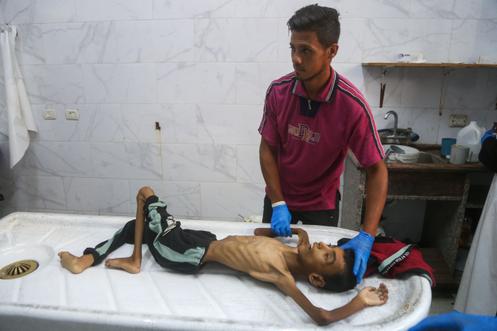 Le corps du jeune Palestinien Abdul Jawad Al-Ghalban, 14 ans, mort de malnutrition, à la morgue de l’hôpital Nasser de Khan Younès, dans le sud de la bande de Gaza, le 22 juillet 2025.