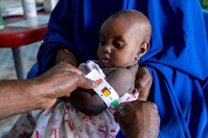 Examen pour détecter la malnutrition chez les enfants de 6 mois à 5 ans, à Maiduguri (Nigeria), le 14 juillet 2025.