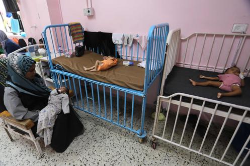 Des enfants hospitalisés pour malnutrition, à l’hôpital Nasser, à Khan Younès (Gaza), le 24 juillet 2025.