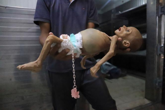 Le corps de Zainab Abu Halib, un bébé de cinq mois mort de malnutrition, à l’hôpital Nasser, Khan Younès, dans la bande de Gaza, le samedi 26 juillet 2025.