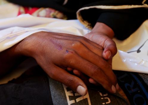 Lors des funérailles de Palestiniens, à l’hôpital Nasser de Khan Younès (Gaza), le 27 juillet 2025.