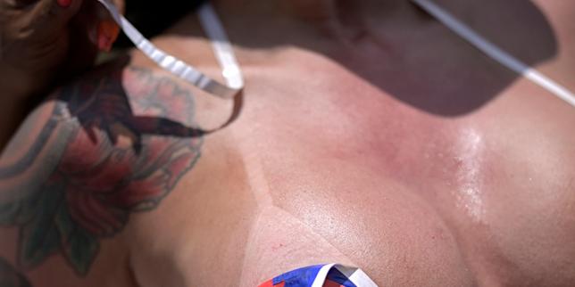 « Tan lines » et « burn lines » : le ministre de la santé met en garde contre des bronzages dangereux popularisés sur les réseaux