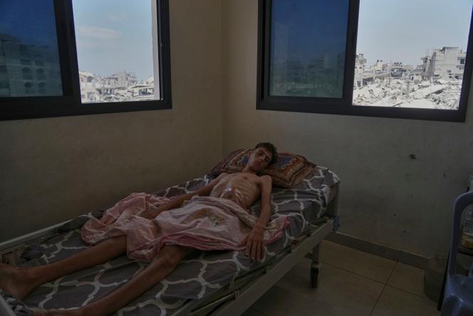 Hamada Al-Kilani, 18 ans, blessé à l’abdomen par un tir de char israélien, est soigné à l’hôpital Shifa, où les médecins soulignent des signes de malnutrition, à Gaza, le 18 août 2025.