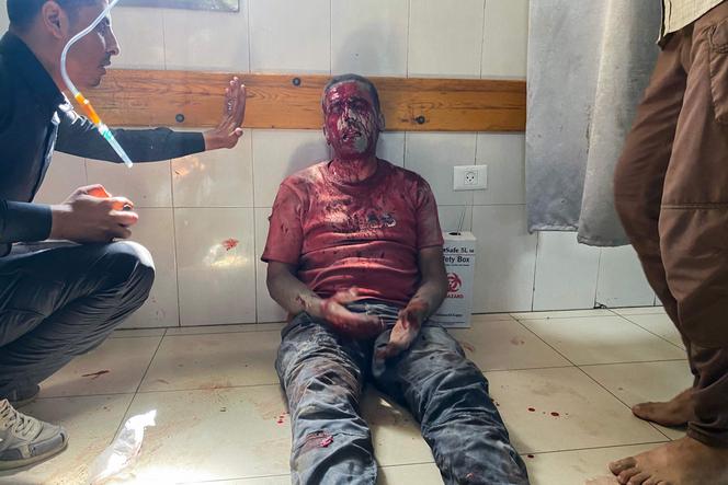 Le photographe de Reuters Hatem Omar, blessé lors des frappes israéliennes sur l’hôpital Nasser à Khan Younès, dans le sud de la bande de Gaza, le 25 août 2025.