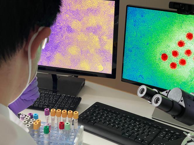 Un technicien de laboratoire effectuant des recherches à partir d’images du virus de l’hépatite A, le 5 septembre 2021.