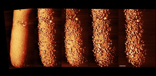 Image composite d’« E. coli » exposée à l’antibiotique polymyxine B. De gauche à droite : bactérie non traitée par l’antibiotique ; bactérie après quinze minutes ; après trente minutes ; après soixante minutes ; après quatre-vingt-dix minutes.