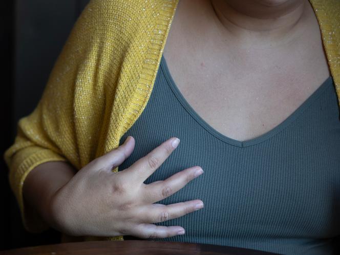 Une femme qui a été malade du cancer, à Paris, le 19 septembre 2024.