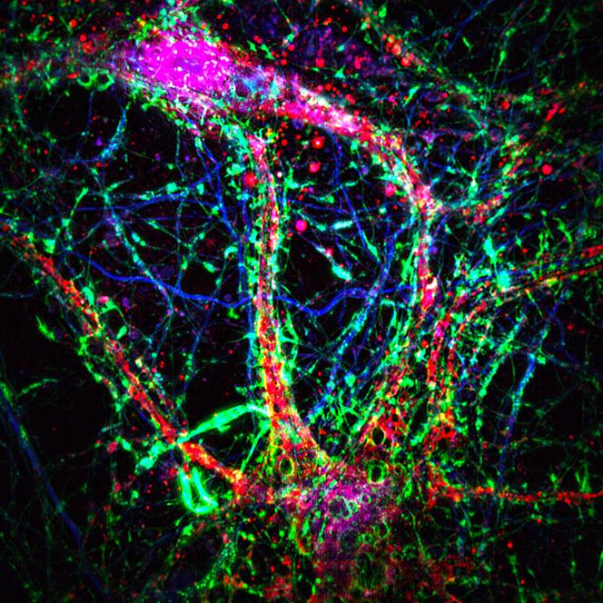 Les nanotubes intercellulaires (connexions fines, de couleur verte, semblables à des ponts) contribuent à la création d’une couche supplémentaire de réseaux de communication entre les neurones.