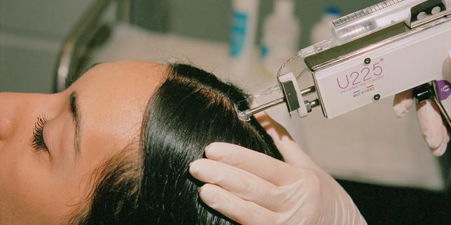Une cliente de Maison Lutétia subit un traitement par micro-injections visant à stimuler la pousse des cheveux.