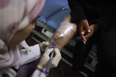 Une infirmière assiste un jeune Palestinien amputé, à l’hôpital Cheikh-Hamad de Gaza, le 16 novembre 2025.