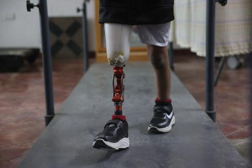 Un enfant palestinien amputé à la suite d’une malformation congénitale teste une prothèse à l’hôpital Cheikh-Hamad, à Gaza, le 16 novembre 2025.