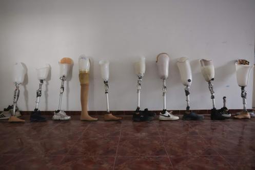 Des prothèses sont disposées contre un mur à l’intérieur de l’hôpital Cheikh-Hamad, à Gaza, le 16 novembre 2025.