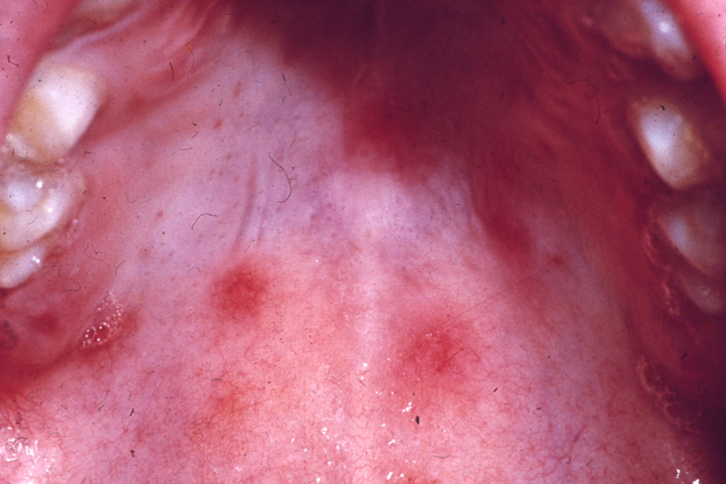 quand une fellation ou un cunnilingus conduit chez le dermatologue ou le dentiste quand une fellation ou un cunnilingus conduit chez le dermatologue ou le dentiste