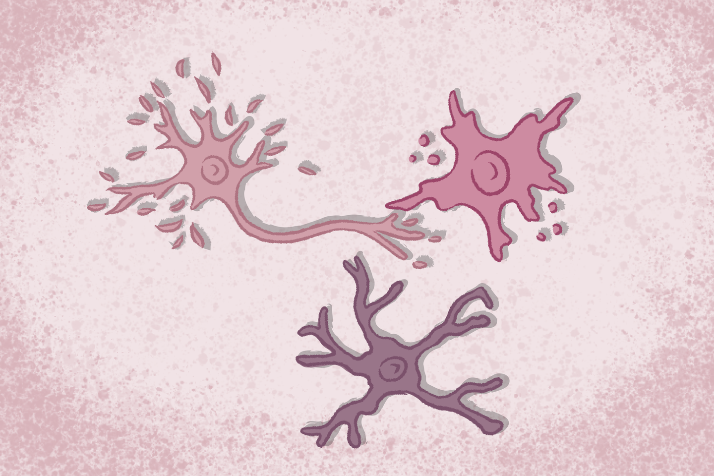 Comment meurent les neurones, en cas de maladie neurodégénérative ? Comment meurent les neurones, en cas de maladie neurodégénérative ?