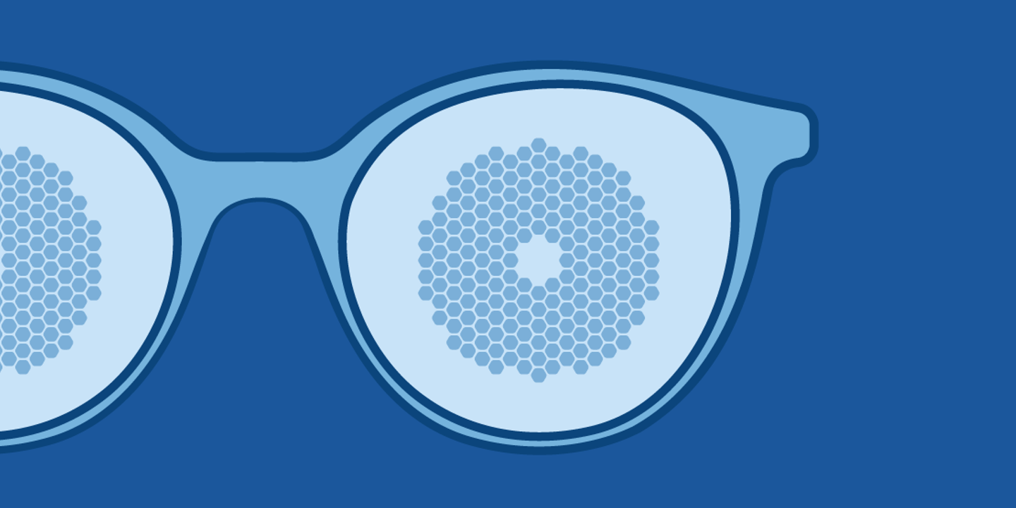 Myopie : comprendre la flambée planétaire et les innovations qui pourraient la freiner