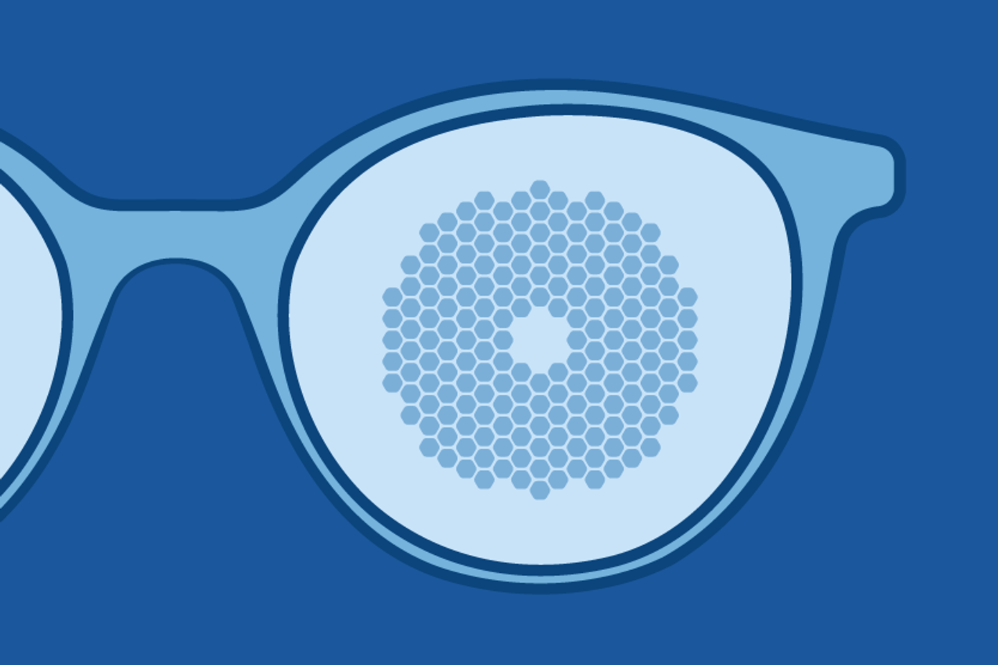 MyopieÂ : comprendre la flambÃ©e planÃ©taire et les innovations qui pourraient la freiner