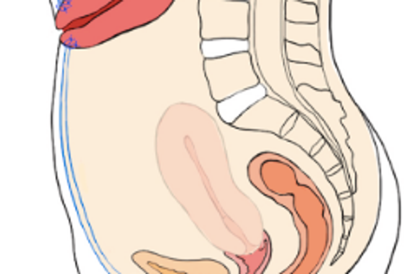 Déplacer l’utérus pour préserver la fertilité d’une jeune femme atteinte d’un cancer pelvien