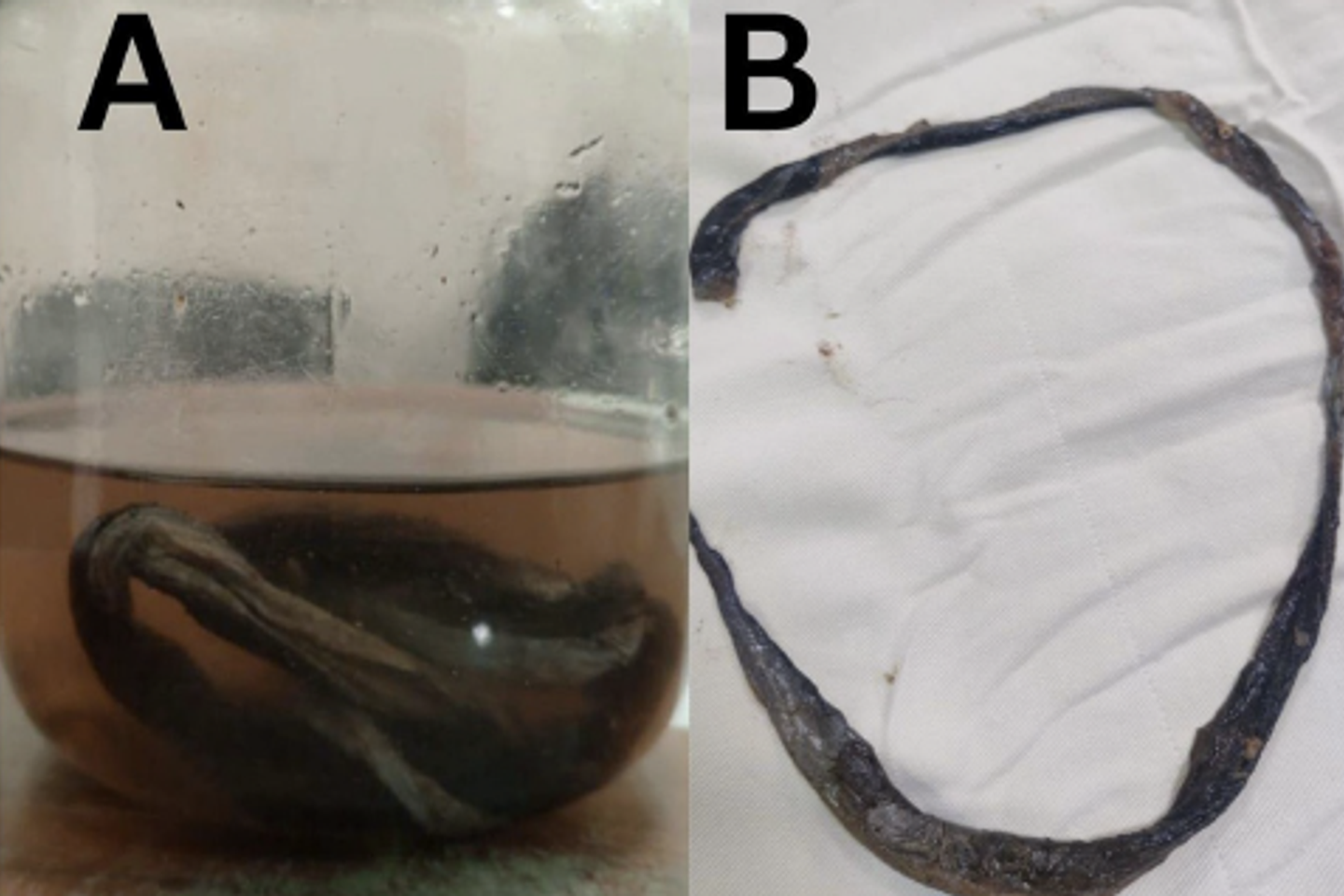 Dans le rectum, un corps étranger vivant se faufile comme une anguille, littéralement Dans le rectum, un corps étranger vivant se faufile comme une anguille, littéralement