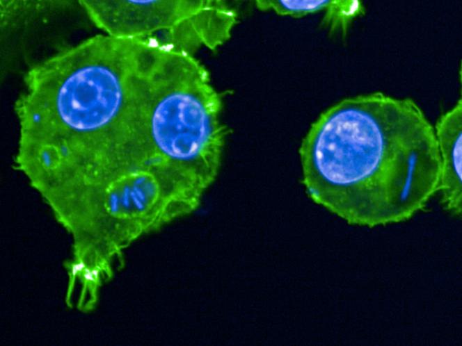 Cette image prise au microscope en&nbsp;2024,&nbsp;et publiée par l’Institut Pasteur le 27&nbsp;mai&nbsp;2025,&nbsp;montre des macrophages infectés par la bactérie «&nbsp;Yersinia pestis&nbsp;». 